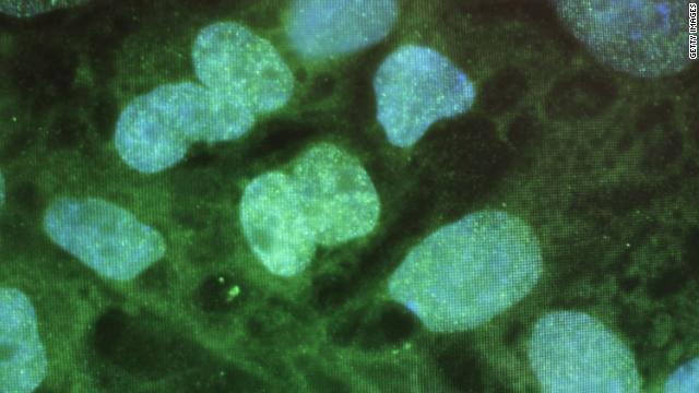 130806170313-stem-cells-uconn-horizontal-gallery.jpg
