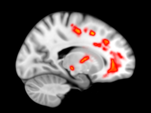 635685009066595675-left-side-view.png