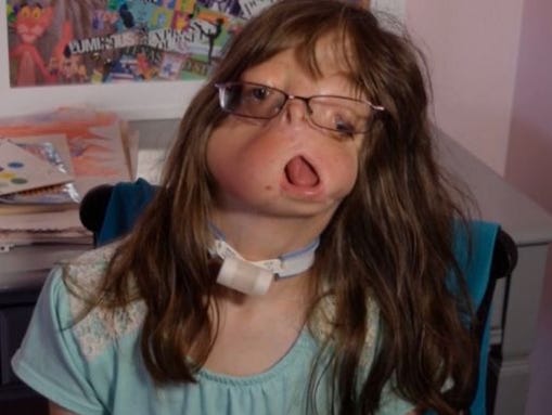 635735964994361320-635732976168324974-0724-tyler-bone-condition-5.JPG