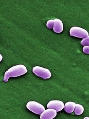 635768954429471331-Anthrax-spores-CDC-photo.jpg