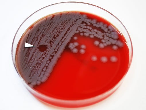 635683497585326032-XXX-Anthrax-bacteria07.jpg